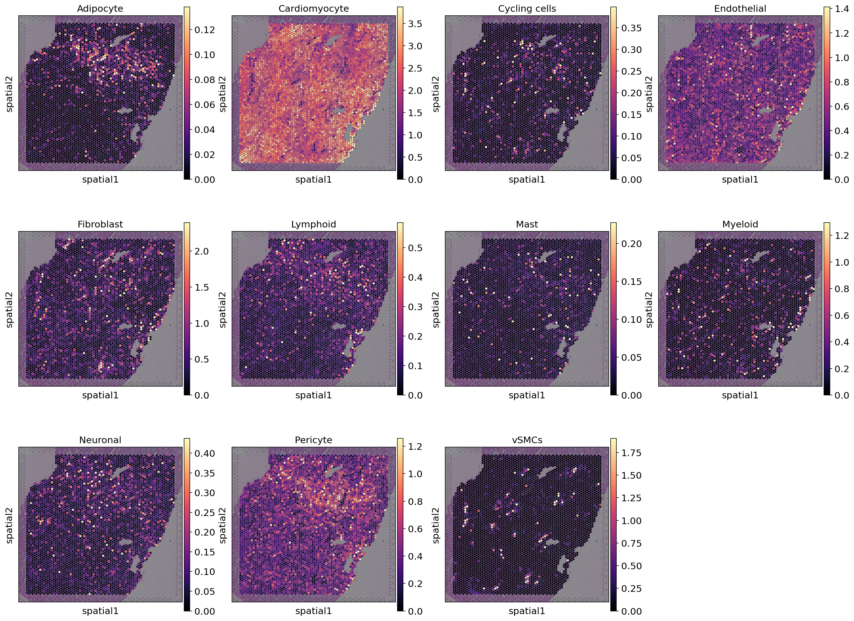<Figure size 1708.8x1200 with 22 Axes>